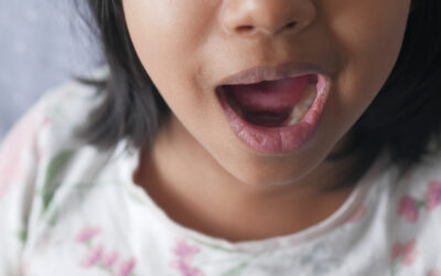 Sequedad Bucal y Garganta: Causas y Tratamientos
