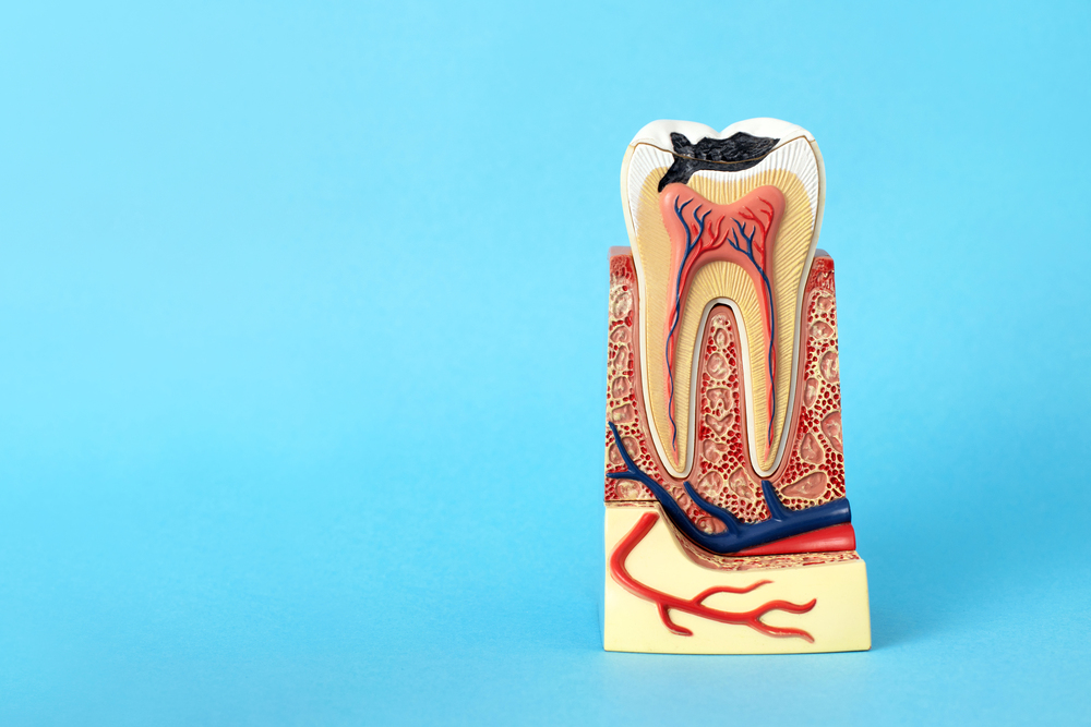 Síntomas De Una Caries Profunda: Señales De Alarma Urgentes 2 Principales Señales de Caries Avanzada que No Debes Pasar por Alto