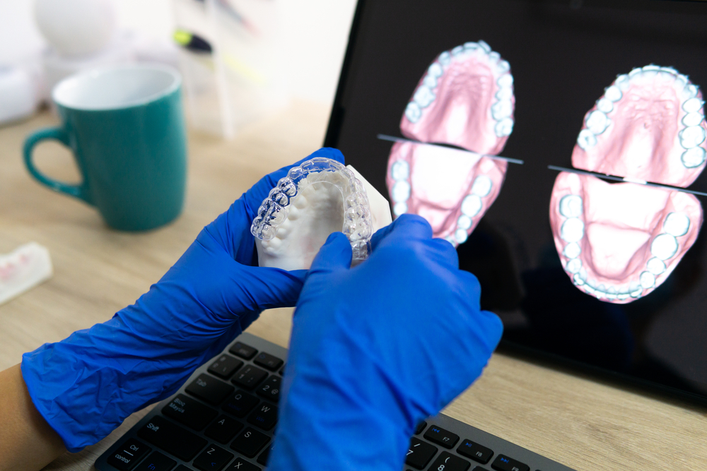 Casos que la ortodoncia invisible corrige de manera más efectiva