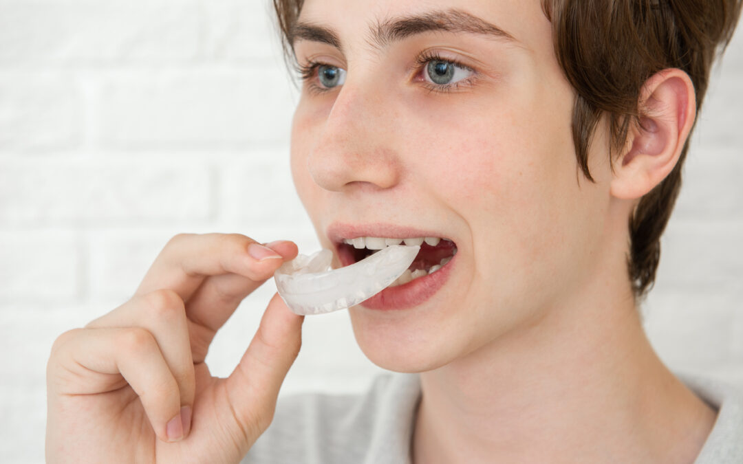 Invisalign vs brackets: diferencias en comodidad y control
