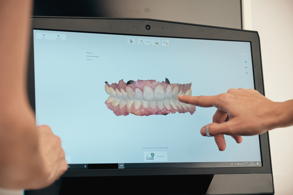 Preguntas frecuentes (FAQ) sobre cuándo elegir Invisalign®