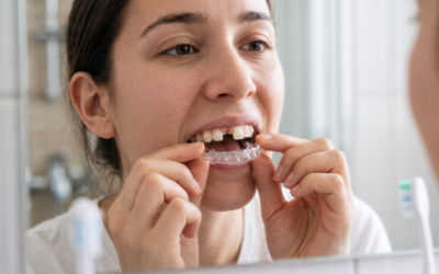 Blog De Ortodoncía En Panamá 2 Se me cayó un atache de Invisalign®: qué informar al ortodoncista y qué evitar